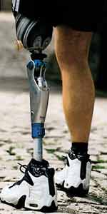 Metalowa proteza nogi