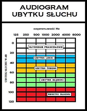 audiogram ubytku słuchu