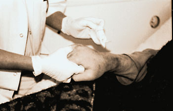 pielęgniarka dezynfekuje dłoń pacjenta